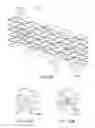 Fig. 98 - Uncaging stent