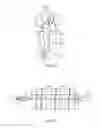 Fig. 05 - Controlled expansion stent graft delivery system