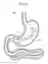 Fig. 25 - Passive caloric bypass device