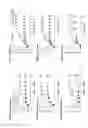 Fig. 05 - Intestinal devices and methods for facilitating weight loss