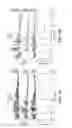 Fig. 06 - Intestinal devices and methods for facilitating weight loss