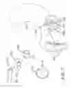 Fig. 09 - Intestinal devices and methods for facilitating weight loss
