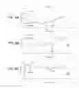 Fig. 10 - Intestinal devices and methods for facilitating weight loss