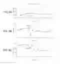 Fig. 11 - Intestinal devices and methods for facilitating weight loss