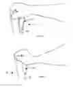 Fig. 05 - Tool supporting wrist brace