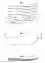 Fig. 04 - Forefoot Orthotic Device