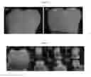 Fig. 02 - REAGENTS AND METHODS FOR WHITENING TEETH