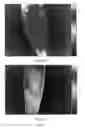 Fig. 02 - COMPOSITION FOR BODY SLIMMING AND SKIN CARE AND PREPARATION METHOD THEREOF