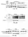 Fig. 10 - Methods of targeting APE/Ref-1 to inhibit hypoxia signaling genes