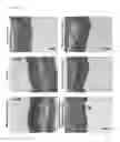 Fig. 09 - Compositions for use in treating inflammatory bowel diseases and intestinal colitis
