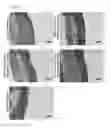 Fig. 10 - Compositions for use in treating inflammatory bowel diseases and intestinal colitis