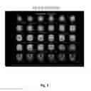 Fig. 04 - METHODS OF TREATING NEURODEGENERATIVE DISEASES USING INDANE ACETIC ACID DERIVATIVES WHICH PENETRATE THE BLOOD BRAIN BARRIER