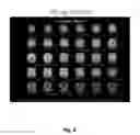 Fig. 05 - METHODS OF TREATING NEURODEGENERATIVE DISEASES USING INDANE ACETIC ACID DERIVATIVES WHICH PENETRATE THE BLOOD BRAIN BARRIER