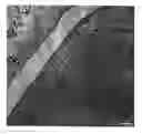 Fig. 01 - Accelerating thrombus resolution through augmentation of p53 activity