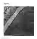 Fig. 04 - Accelerating thrombus resolution through augmentation of p53 activity