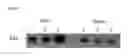 Fig. 07 - Accelerating thrombus resolution through augmentation of p53 activity