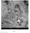 Fig. 02 - Temozolomide powder formulation