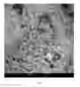 Fig. 04 - Temozolomide powder formulation