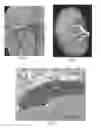 Fig. 02 - Polymeric treatment compositions