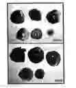 Fig. 01 - Bifidobacteria for treating cardiac conditions