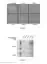 Fig. 04 - METHOD AND COMPOSITIONS FOR THE USE OF BOTANICAL EXTRACTS IN THE TREATMENT OF VIRAL INFECTIONS, CANCER, PAIN, ITCH, AND INFLAMMATION