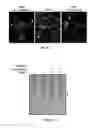 Fig. 05 - METHOD AND COMPOSITIONS FOR THE USE OF BOTANICAL EXTRACTS IN THE TREATMENT OF VIRAL INFECTIONS, CANCER, PAIN, ITCH, AND INFLAMMATION