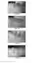 Fig. 16 - METHOD AND COMPOSITIONS FOR THE USE OF BOTANICAL EXTRACTS IN THE TREATMENT OF VIRAL INFECTIONS, CANCER, PAIN, ITCH, AND INFLAMMATION