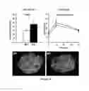 Fig. 06 - Methods for treating metabolic disorders using FGF