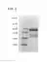 Fig. 04 - MULTIMERIC IL-15-BASED MOLECULES