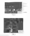 Fig. 04 - Article with foamed surface, implant and method of producing the same