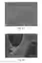 Fig. 06 - Article with foamed surface, implant and method of producing the same