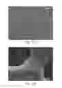 Fig. 09 - Article with foamed surface, implant and method of producing the same