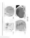 Fig. 03 - Medication infusion components and systems