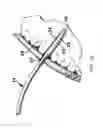 Fig. 11 - Medication infusion components and systems