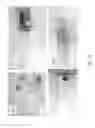 Fig. 23 - Medication infusion components and systems