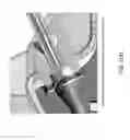 Fig. 49 - Medication infusion components and systems