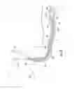 Fig. 09 - Systems and methods for mechanical displacement of an esophagus