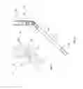 Fig. 11 - Systems and methods for mechanical displacement of an esophagus