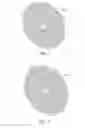 Fig. 05 - Percutaneous driveline anchor devices and methods of use