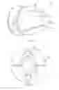 Fig. 07 - Percutaneous driveline anchor devices and methods of use