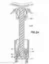 Fig. 18 - Drug reconstitution system