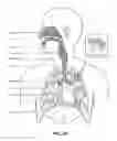 Fig. 05 - Patient interface with volume reducing member