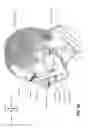 Fig. 08 - Patient interface with volume reducing member