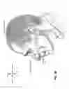 Fig. 09 - Patient interface with volume reducing member