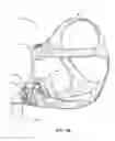 Fig. 14 - Patient interface with volume reducing member