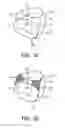Fig. 04 - PATIENT INTERFACE DEVICE FABRIC SUPPORT SLEEVE