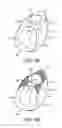 Fig. 05 - PATIENT INTERFACE DEVICE FABRIC SUPPORT SLEEVE