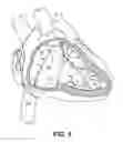 Fig. 08 - Shuttle apparatus and associated systems and methods