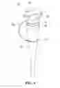 Fig. 10 - Multi-cap for connecting catheter
