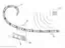 Fig. 01 - Cochlear implant